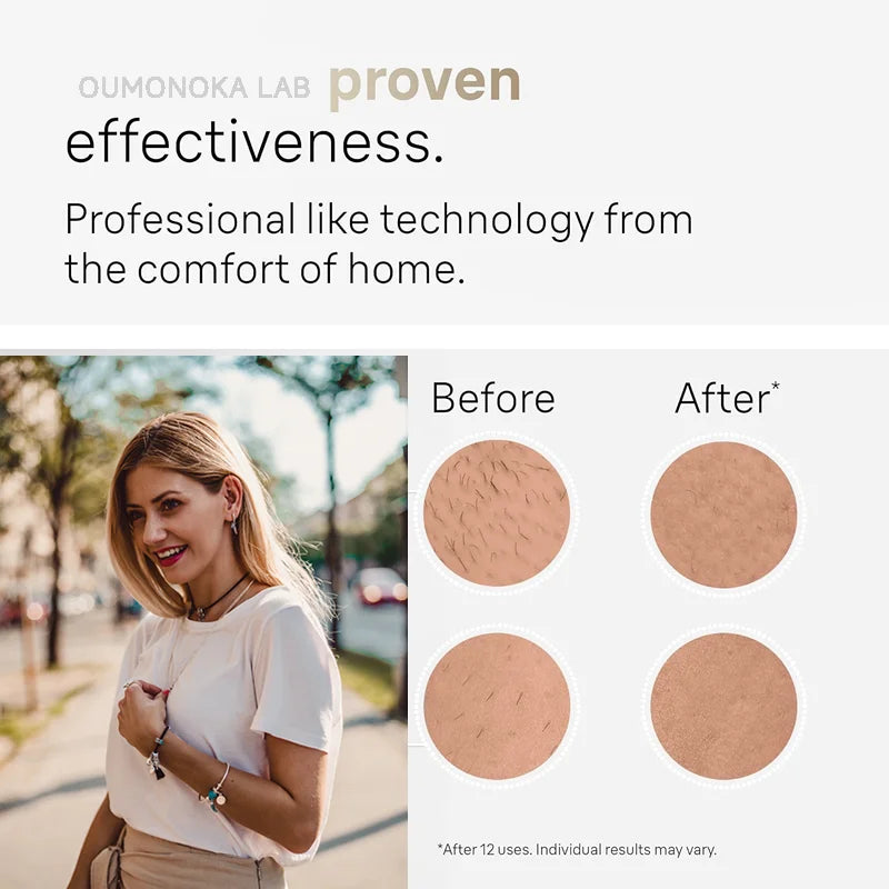 AlignWell IPL Pro Hair Removal Device