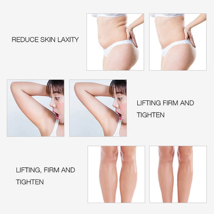 Alignwell RF (Radio Frequency) Color Light Slimming Device