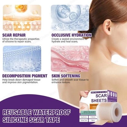 AlignWell ScarFade Silicone Scar Sheets