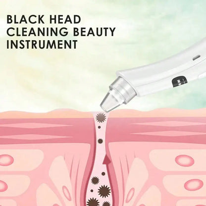 AlignWell PoreVac Pro Blackhead Remover
