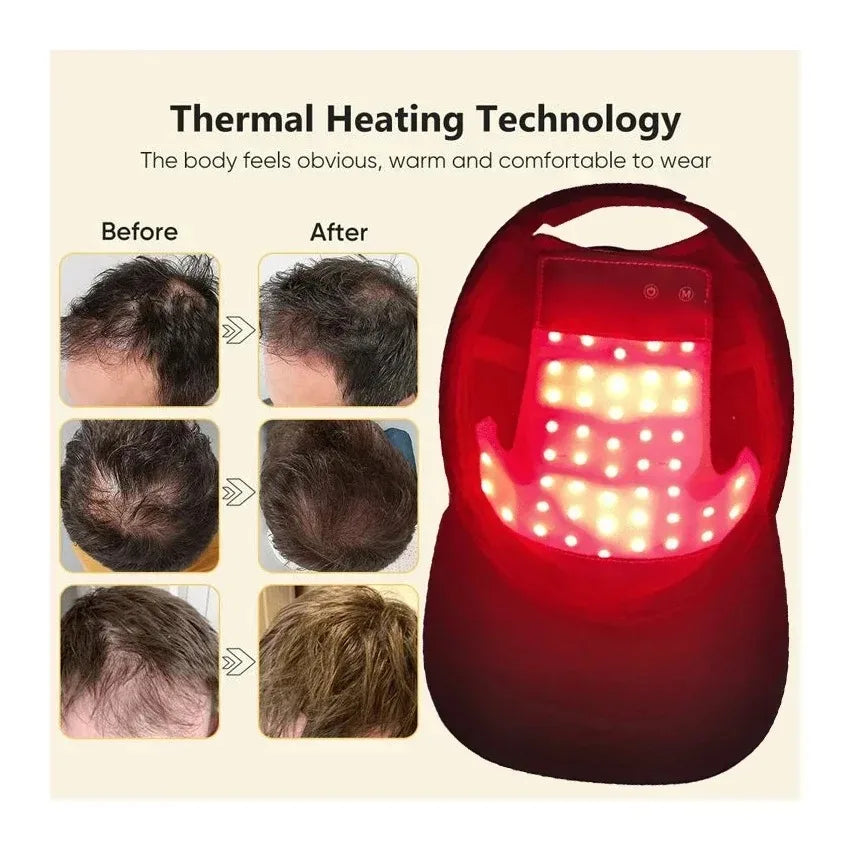 AlignWell LaserGrow LED Hair Therapy Cap