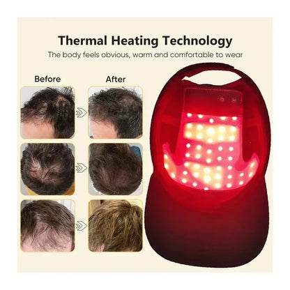 AlignWell LaserGrow LED Hair Therapy Cap
