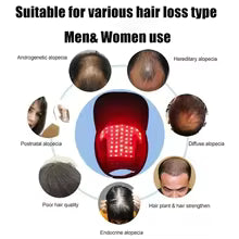 AlignWell LaserGrow LED Hair Therapy Cap