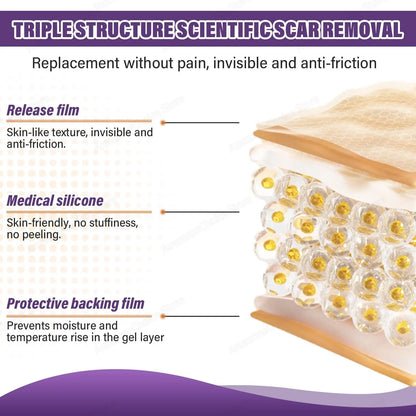 AlignWell ScarFade Silicone Scar Sheets