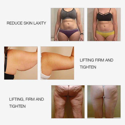Alignwell RF (Radio Frequency) Color Light Slimming Device