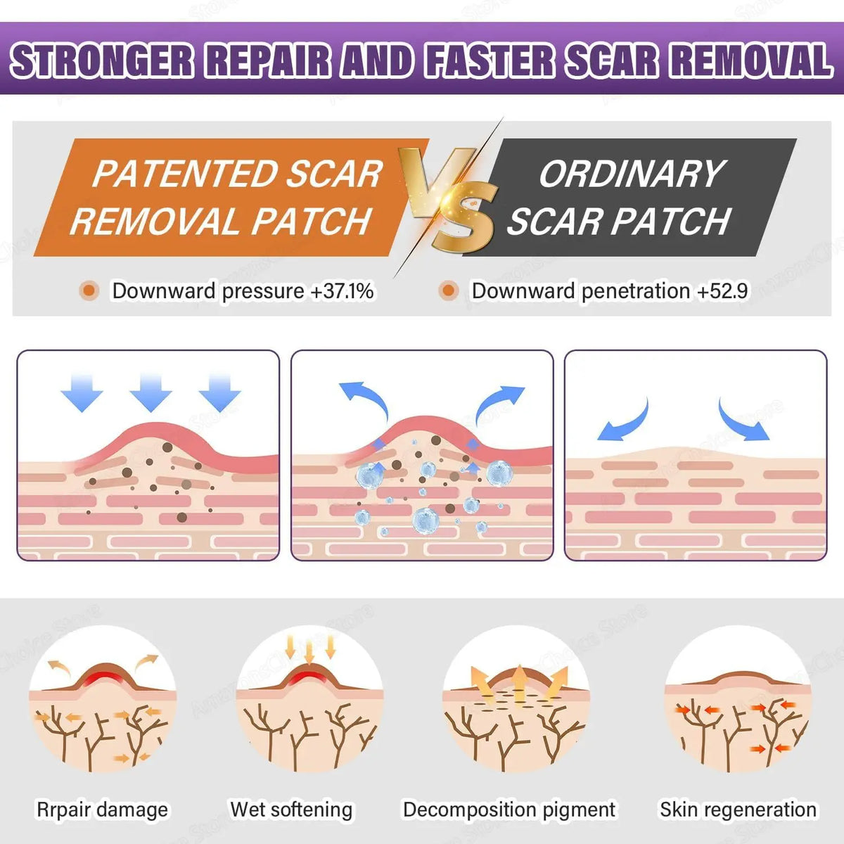 AlignWell ScarFade Silicone Scar Sheets