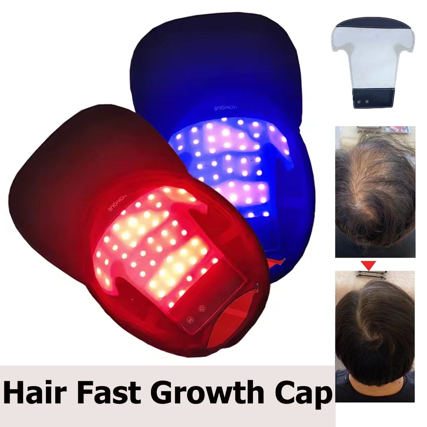 AlignWell LaserGrow LED Hair Therapy Cap