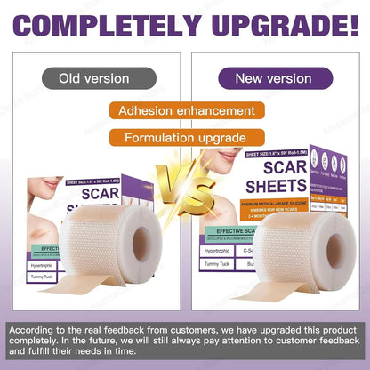 AlignWell ScarFade Silicone Scar Sheets