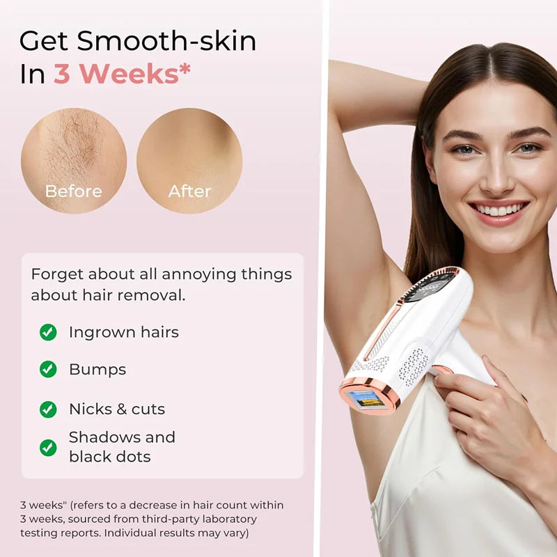 AlignWell IPL Pro Hair Removal Device